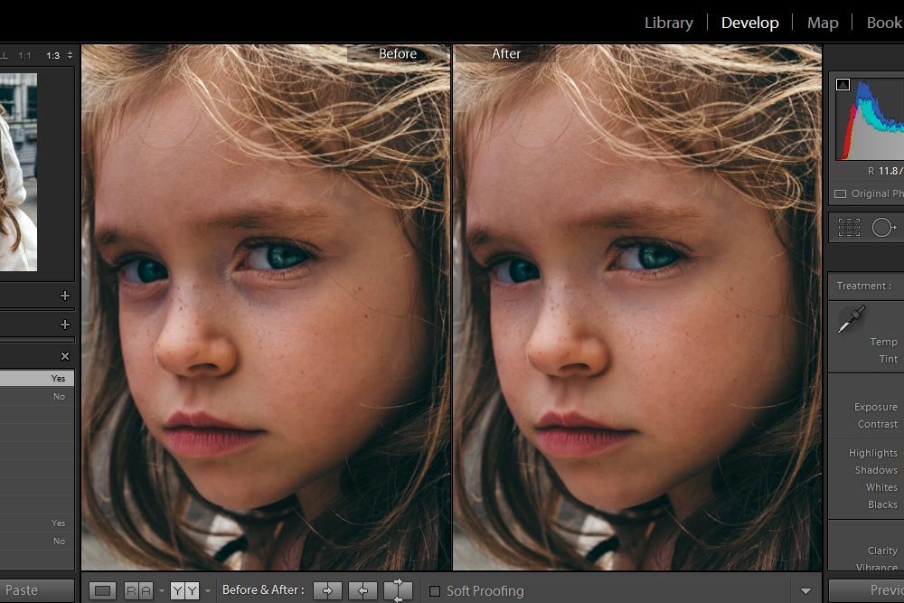 before-after-both-eyes.jpg