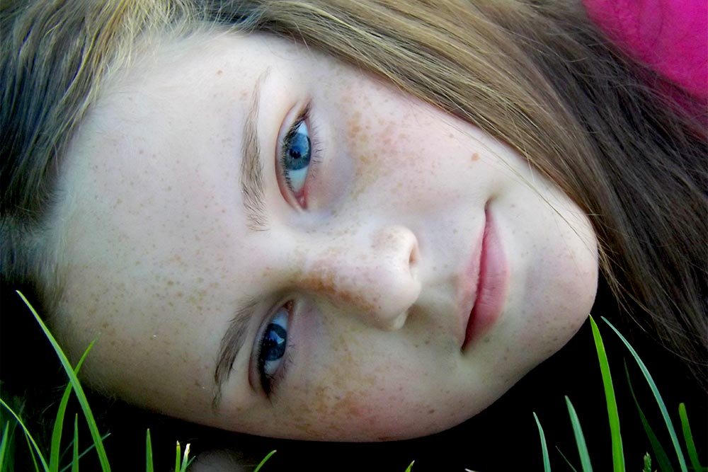 freckle-girl.jpg